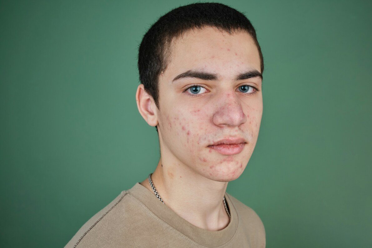 Herpes hero image